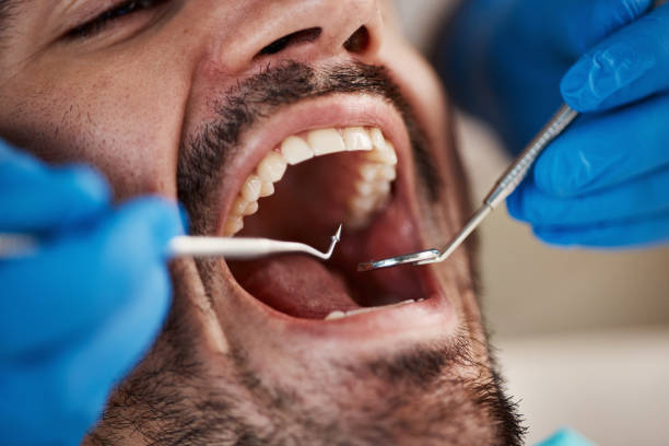 Best Tooth Pain Emergency Relief  in Rochelle, IL